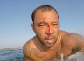 Sunny Garcia a la tête plus dure que vous