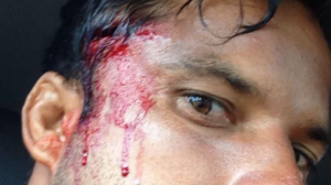 Michel Bourez se blesse à Teahupoo